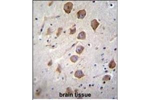 anti-Potassium Channel Regulator (KCNRG) (AA 175-202), (C-Term) antibody