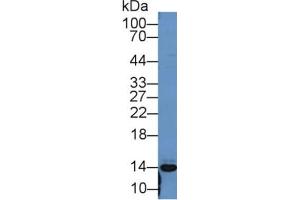 Rabbit Capture antibody from the kit in WB with Positive Control: Mouse spleen lysate. (PF4 Kit CLIA)