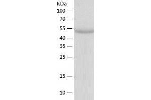 Western Blotting (WB) image for Kruppel-Like Factor 4 (Gut) (KLF4) (AA 1-479) protein (His-IF2DI Tag) (ABIN7123699)