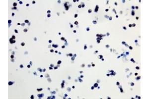 ICC staining of formalin fixed and paraffin embedded human SW40 cells (400X, Negative) with recombinant BRAF V600E antibody. (Recombinant BRAF anticorps  (V600E))