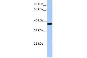 ACTRT2 antibody used at 1 ug/ml to detect target protein. (ACTRT2 anticorps  (C-Term))