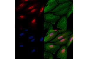 ABIN6262222 and ABIN6278578 staining  cells by IF/ICC. (HES6 anticorps  (N-Term))