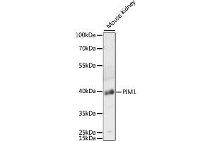 Western blot analysis of extracts of mouse kidney, using PIM1 antibody (ABIN6128456, ABIN6145654, ABIN6145656 and ABIN6218499) at 1:3000 dilution. (PIM1 anticorps  (AA 1-313))