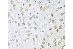Immunohistochemistry of paraffin-embedded Mouse brain using TARS Polyclonal Antibody at dilution of 1:100 (40x lens). (TARS anticorps)