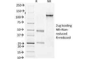 SDS-PAGE Analysis Purified BCL-6 Mouse Monoclonal Antibody (BCL6/1982).