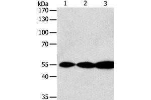 Western Blot analysis of Jurkat, Hela and A549 cell using GSR Polyclonal Antibody at dilution of 1:750 (Glutathione Reductase anticorps)