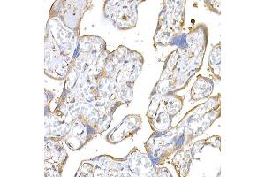 Immunohistochemistry of paraffin-embedded human placenta using M Rabbit pAb (ABIN3021414, ABIN3021415, ABIN3021416 and ABIN6215021) at dilution of 1:500 (40x lens).