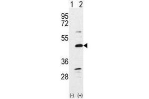 Image no. 1 for anti-Bone Morphogenetic Protein 7 (BMP7) (N-Term) antibody (ABIN357185) (BMP7 anticorps  (N-Term))