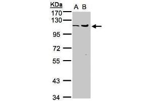 WB Image Sample(30 ug whole cell lysate) A:MOLT4 , B:Raji , 7.