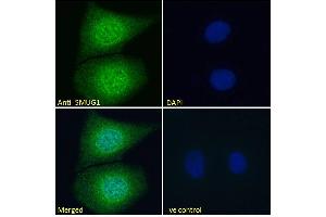 ABIN185204 Immunofluorescence analysis of paraformaldehyde fixed MCF7 cells, permeabilized with 0.