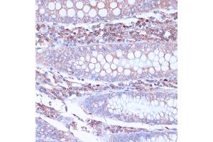 Immunohistochemistry of paraffin-embedded human colon using CD38 antibody (ABIN6130076, ABIN6138177, ABIN6138178 and ABIN6217677) at dilution of 1:100 (40x lens). (CD38 anticorps  (AA 46-300))