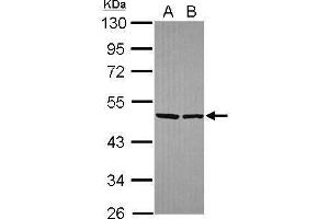 WB Image Sample (30 ug of whole cell lysate) A: Hela B: Hep G2 , 10% SDS PAGE antibody diluted at 1:10000 (EIF4A2 anticorps)