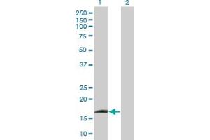 Western Blot analysis of IFNA13 expression in transfected 293T cell line by IFNA13 MaxPab polyclonal antibody. (IFNA13 anticorps  (AA 1-189))