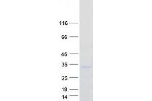 Validation with Western Blot