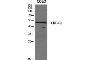 Western Blot (WB) analysis of specific cells using CRF-RII Polyclonal Antibody. (CRHR2 anticorps  (Internal Region))
