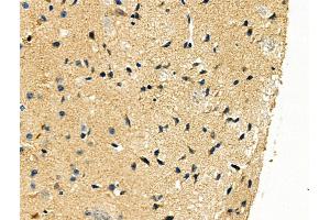 ABIN6262442 and ABIN6276447 at 1/100 staining Mouse brain tissue by IHC-P. (Id2 anticorps  (C-Term))