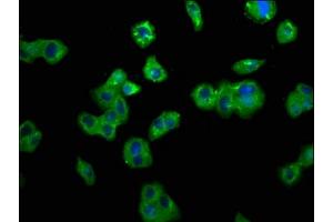 Immunofluorescence staining of HepG2 cells with ABIN7173829 at 1:200, counter-stained with DAPI. (TNFRSF1B anticorps  (AA 56-210))