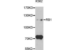 Western blot analysis of extracts of K-562 cells, using RB1 antibody (ABIN5995517) at 1:3000 dilution. (Retinoblastoma 1 anticorps)