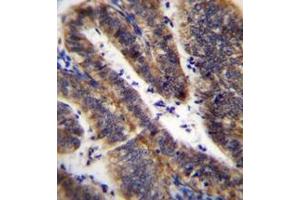 Immunohistochemistry analysis in formalin fixed and paraffin embedded human uterus tissue reacted with LRRN4CL Antibody (Center) followed which was peroxidase conjugated to the secondary antibody and followed by DAB staining.