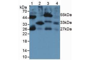 Figure. (IL-33 anticorps  (AA 110-261))
