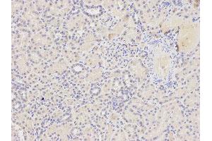 Immunohistochemistry of paraffin-embedded human kidney using FAS antibody at dilution of 1:400 (200x lens). (FAS anticorps)