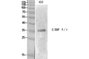 Western Blot (WB) analysis of specific cells using C/EBP epsilon Polyclonal Antibody. (CEBPE anticorps  (Ser2448))