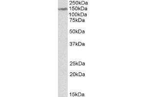 ABIN2563702 (2µg/ml) staining of Human Cerebellum lysate (35µg protein in RIPA buffer). (LMTK2 anticorps  (Internal Region))
