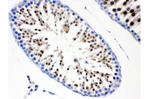 Immunohistochemistry (Paraffin-embedded Sections) (IHC (p)) image for anti-Cell Division Cycle 6 Homolog (S. Cerevisiae) (CDC6) (AA 147-549) antibody (ABIN3043500)