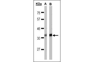 Western blot: Sample (30 µg of whole cell lysate). (FFAR1 anticorps  (AA 239-300))