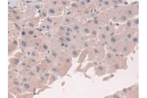 Detection of GCA in Human Liver Tissue using Polyclonal Antibody to Grancalcin (GCA)