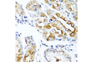 Immunohistochemistry of paraffin-embedded human stomach using CCL21 antibody.