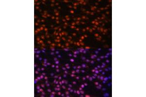 Immunofluorescence analysis of C6 cells using FOSL1 antibody (ABIN6131653, ABIN6140738, ABIN6140739 and ABIN6221016) at dilution of 1:100.