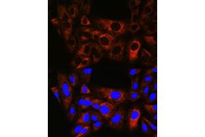 Immunofluorescence analysis of U-2 OS cells using HSPB8/HSP22 Rabbit mAb (ABIN6132943, ABIN6144482, ABIN6144483 and ABIN7101424) at dilution of 1:100 (40x lens).