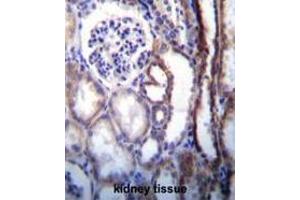 ATP6V1B1 Antibody (Center) immunohistochemistry analysis in formalin fixed and paraffin embedded human kidney tissue followed by peroxidase conjugation of the secondary antibody and DAB staining. (ATP6V1B1 anticorps  (Middle Region))