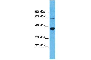 Western Blotting (WB) image for anti-Olfactory Receptor, Family 5, Subfamily D, Member 13 (OR5D13) (C-Term) antibody (ABIN2791752) (OR5D13 anticorps  (C-Term))