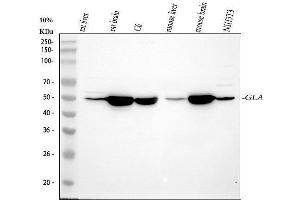 Western blot analysis of Gla using anti-Gla antibody (ABIN4886604).