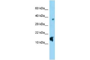 WB Suggested Anti-Nppc Antibody Titration: 1. (NPPC anticorps  (C-Term))