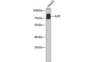 Western blot analysis of extracts of HepG2 cells, using ALPI Antibody (ABIN6127419, ABIN6136822, ABIN6136823 and ABIN6221820) at 1:1000 dilution.