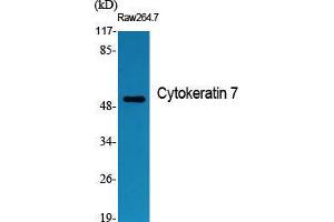 Western Blot (WB) analysis of specific cells using Cytokeratin 7 Polyclonal Antibody.
