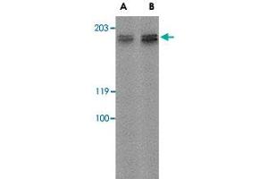 Western blot analysis of GPR124 in rat kidney tissue lysate with GPR124 polyclonal antibody  at (A) 2 ug/mL and (B) 4 ug/mL . (GPR124 anticorps  (Internal Region))