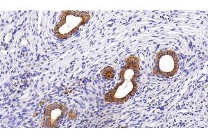 Detection of CK5 in Rat Uterus Tissue using Polyclonal Antibody to Cytokeratin 5 (CK5)