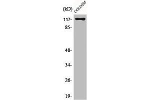 Western Blot analysis of COLO205 cells using C/EBP ζ Polyclonal Antibody (CEBPZ anticorps  (N-Term))