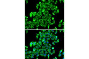 Immunofluorescence analysis of MCF7 cell using RPL13 antibody. (RPL13 anticorps)