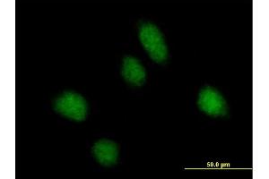 Immunofluorescence of purified MaxPab antibody to REPS1 on HeLa cell.