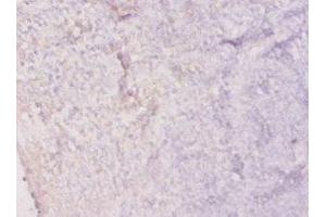 Immunohistochemistry of paraffin-embedded human tonsil tissue using ABIN7156020 at dilution of 1:20 (HPRT1 anticorps  (AA 2-218))