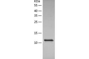 Western Blotting (WB) image for Vascular Endothelial Growth Factor A (VEGFA) (AA 27-147) protein (His tag) (ABIN7125701)