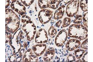 Immunohistochemical staining of paraffin-embedded Human Kidney tissue using anti-MMAA mouse monoclonal antibody. (MMAA anticorps)
