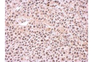IHC-P Image Immunohistochemical analysis of paraffin-embedded HeLa xenograft, using PSMC6, antibody at 1:500 dilution.