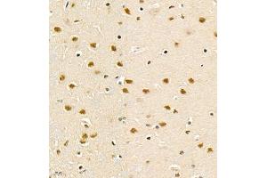 Immunohistochemistry of paraffin embedded rat brain using PHF10 (ABIN7075029) at dilution of 1:1200 (400x lens)
