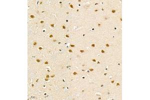 Immunohistochemistry of paraffin embedded rat brain using PHF10 (ABIN7075029) at dilution of 1:1200 (400x lens) (PHF10 anticorps)